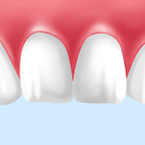 STEP06：歯の色の確認