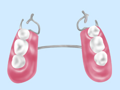 部分入れ歯
